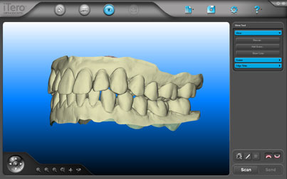 3D Scan